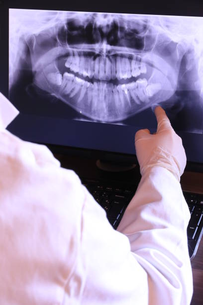 Best Emergency Dental Care for Broken or Chipped Teeth in , NY